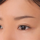 eyebrow